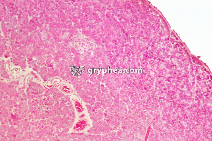 Pancréas diabétique x40 - gryphea.org